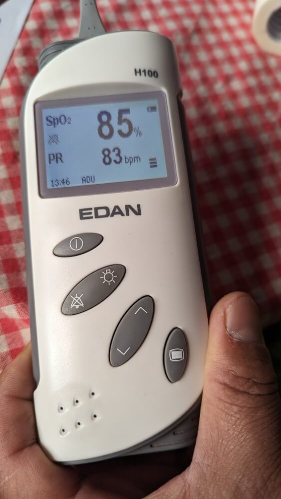 Großaufnahme eines Pulsoximeters zur Sauerstoffmessung.